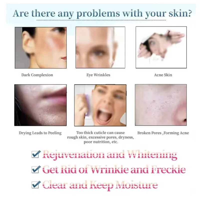 Red Light Therapy Bed Beauty and Skin Whitening - Image 5